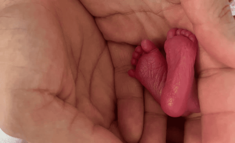 Atención a recién nacido sano ofrecida por la Dra. Ingrid Kuhn: cuidado integral desde la primera respiración